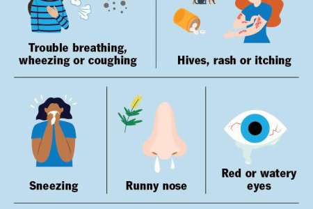Allergies