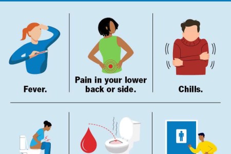 Kidney Infection (Pyelonephritis)