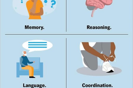 Alzheimer’s Disease