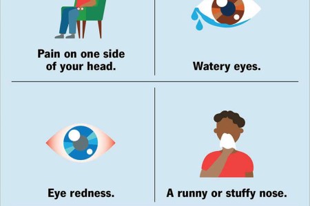 Cluster Headaches