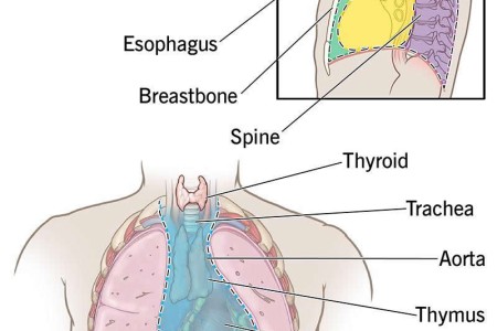 Mediastinal Tumor