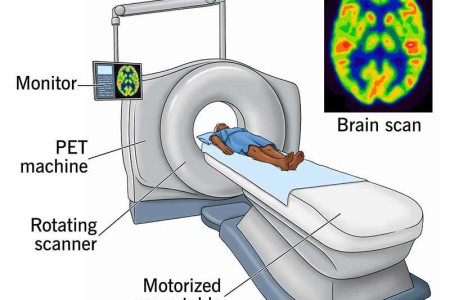 PET Scan