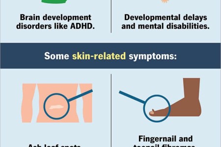 Tuberous Sclerosis