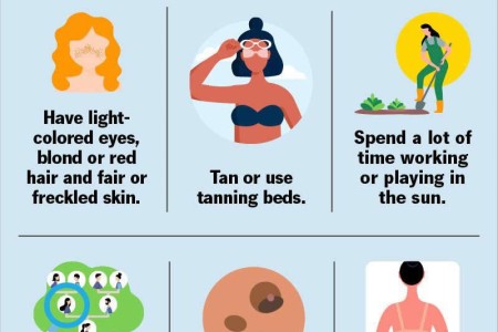 Skin Cancer