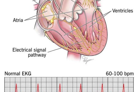 Electrocardiogram (ECG/EKG)