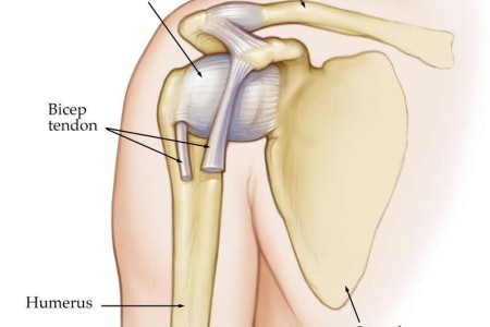 Dislocated Shoulder