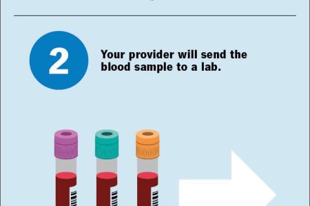 Sedimentation Rate (ESR) Test