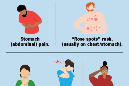 Typhoid Fever