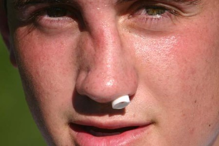 Broken Nose