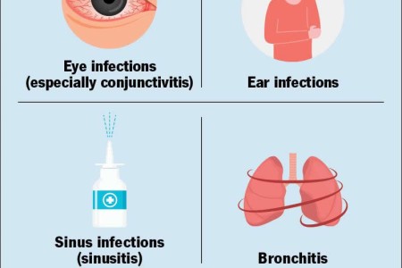 IgA Deficiency