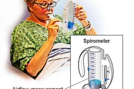 Pulmonary Function Testing