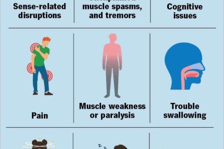 Functional Neurological Disorder (Formerly Conversion Disorder)