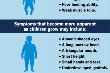 Prader-Willi Syndrome