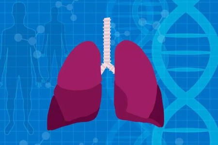 Can You Inherit Pulmonary Hypertension? Here’s What You Should Know