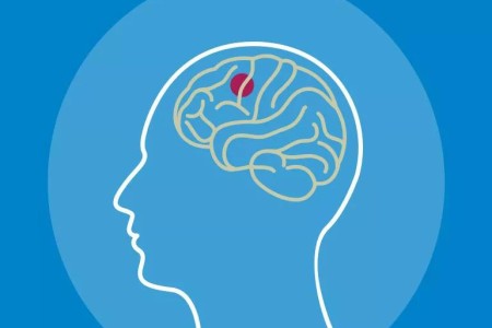 Experimental Glioblastoma Vaccine Shows Promise in Slowing Brain Tumor Growth