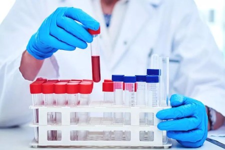 Blood Tests: How’s Your Metabolism? A BMP Can Tell You