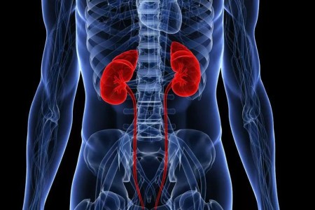 Renal Aneurysms:  When Should You Have Yours Repaired?