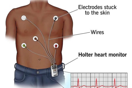 Holter Monitor