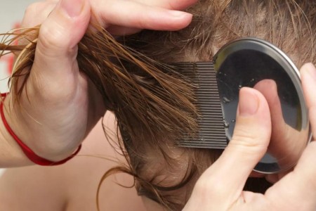 The 4 Head Lice Facts That Every Parent Needs to Know