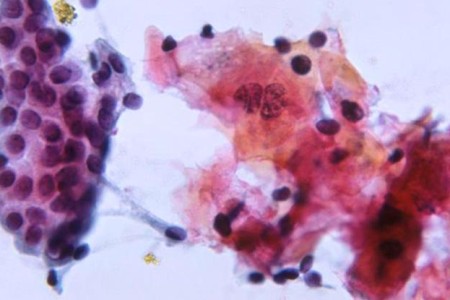 Cytology (Cytopathology)