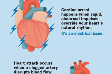 Cardiac Arrest