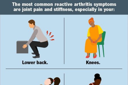 Reactive Arthritis (Reiter's Syndrome)