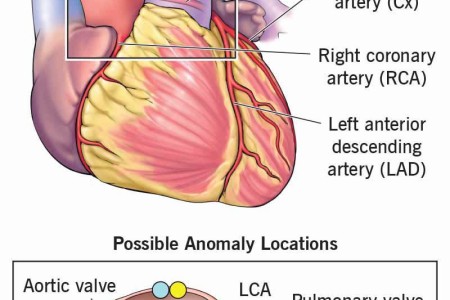 Anomalous Coronary Artery