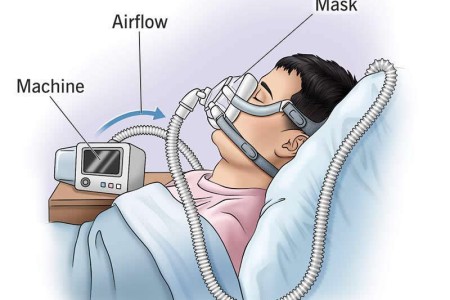 CPAP Machine