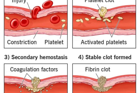 Hemostasis