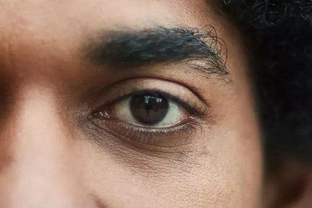 Why You Have That Pesky Eye Twitch — and When to Seek Help