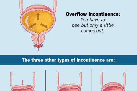 Overflow Incontinence