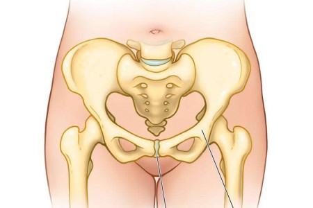 Symphysis Pubis Dysfunction
