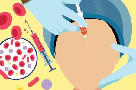 Can a ‘Vampire Facial’ Make You Look Younger?