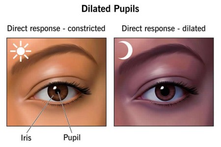 Dilated Pupils (Mydriasis)