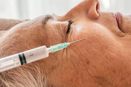 How to Smooth Away Laugh Lines With or Without Surgery
