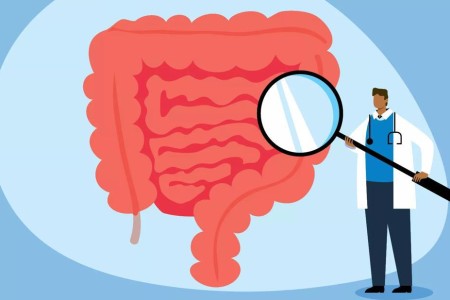 Which Colorectal Cancer Screening Method Is Right for You?