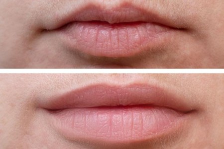 Lip Flip
