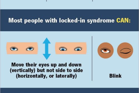 Locked-in Syndrome (LiS)