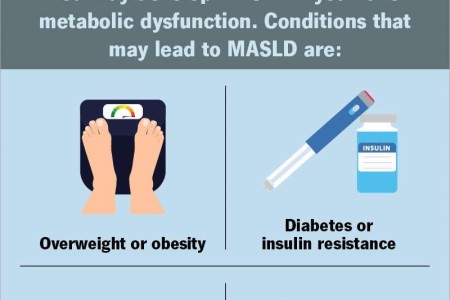 Metabolic Dysfunction-Associated Steatotic Liver Disease (MASLD)