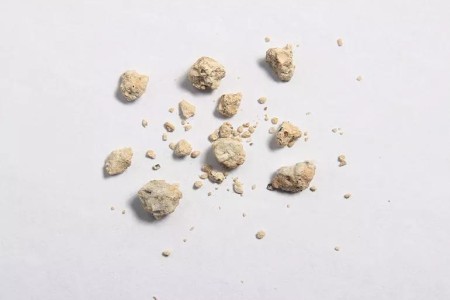 Are There Home Remedies for Kidney Stones?