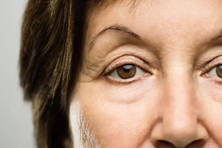 How To Fix Droopy Eyelids, Circles and Sags