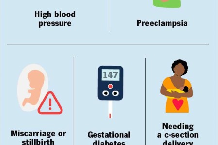 Advanced Maternal Age