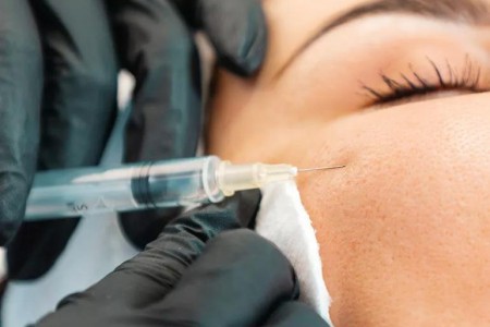 What To Know About Dermal Fillers and Botox