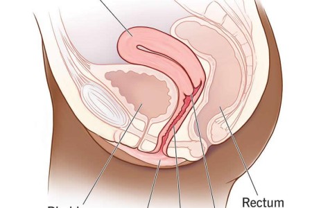 Anteverted Uterus