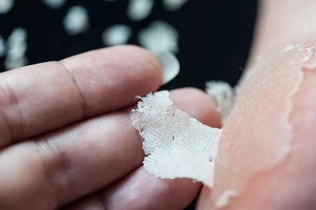 Do Foot Peels Actually Work?