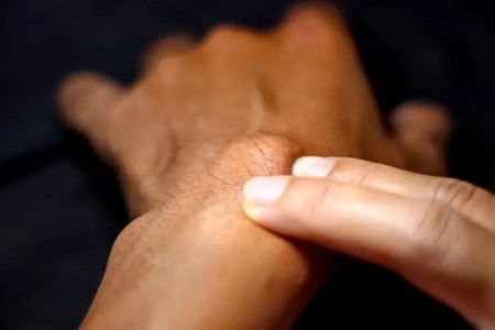 What’s the Difference Between a Cyst and a Tumor?