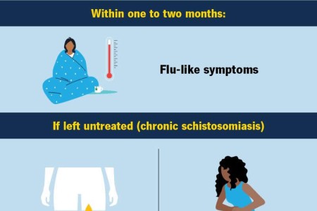 Schistosomiasis