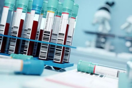 The Galleri Test: A New Blood Test for Cancer Screening