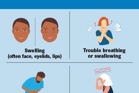 Angioedema