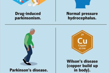 Parkinsonism